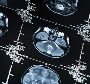 Image showing a MRI scan of a human head