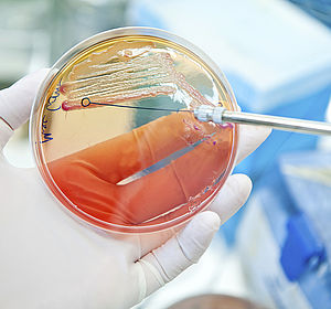 Image showing Petri dish seeded with Escherichia Coli bacteria