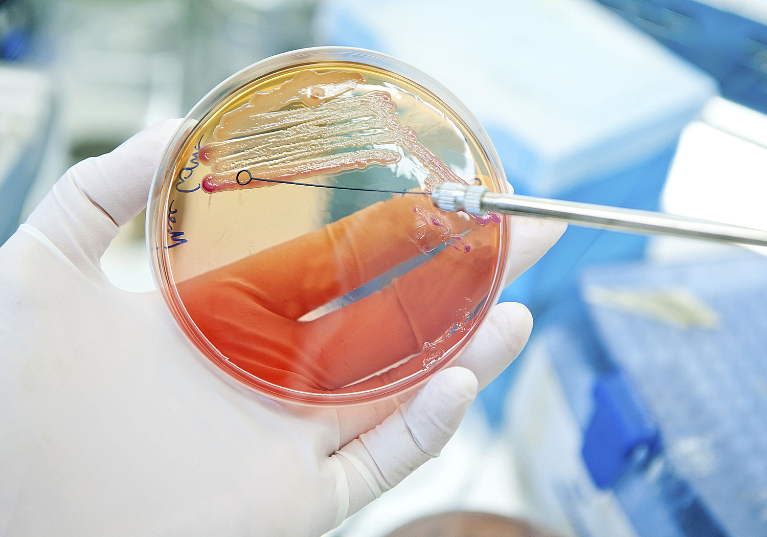 Image showing Petri dish seeded with Escherichia Coli bacteria