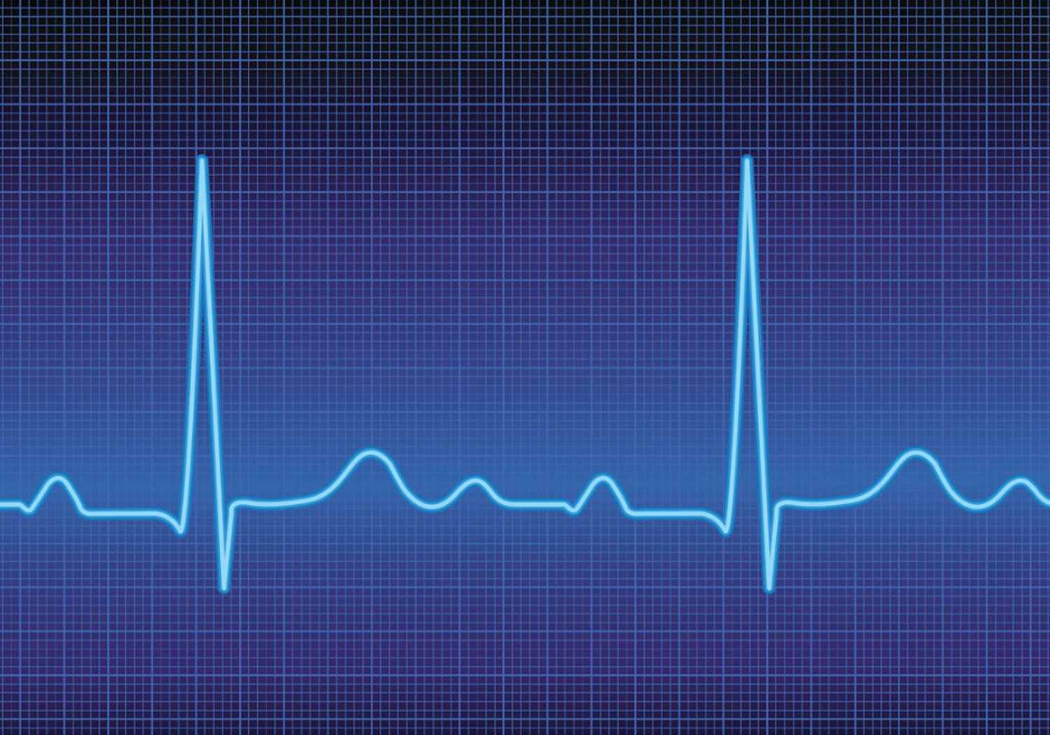 Image of heart beats on a ECG