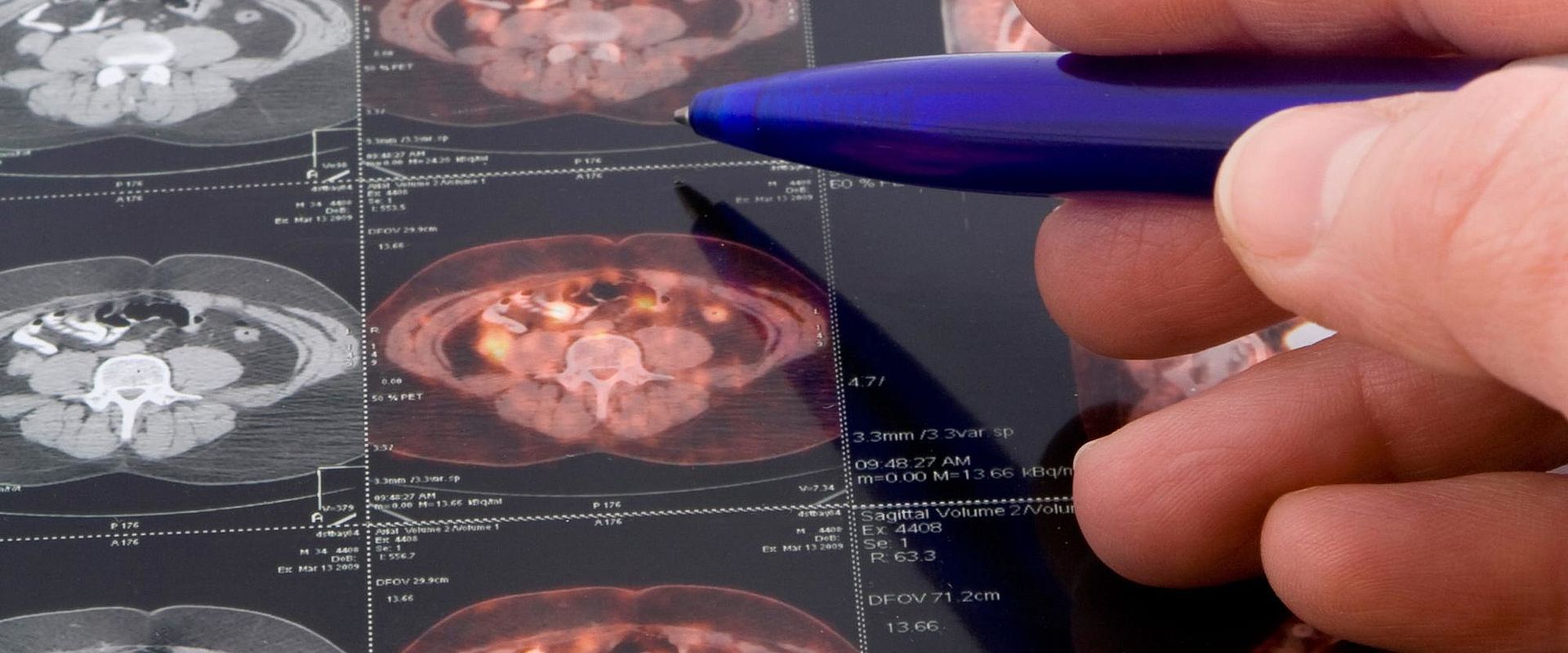 IStock 117906740 Positron emission tomography web